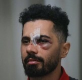 عکس | اولین تصویر از امید عالیشاه پس از مصدومیت دلخراش